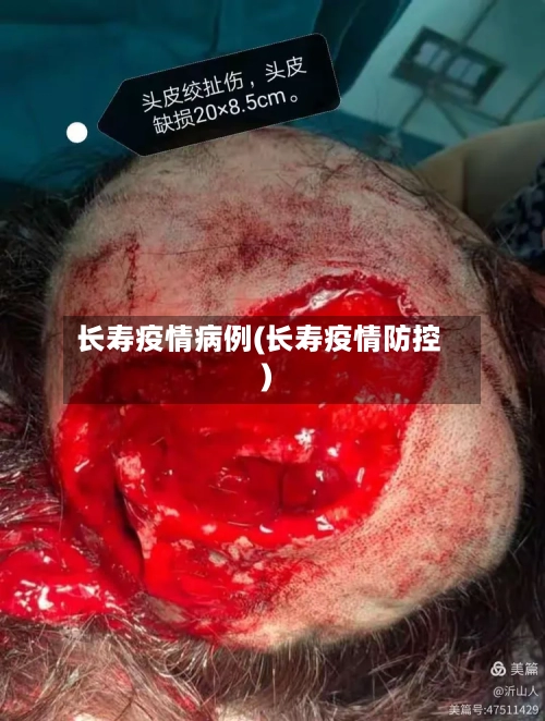 长寿疫情病例(长寿疫情防控)-第1张图片