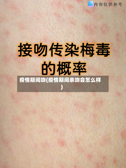 疫情期间吻(疫情期间亲吻会怎么样)-第1张图片